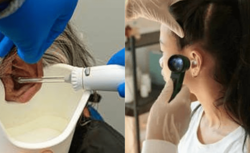 Syringing vs. Microsuction ; best way to remove ear wax